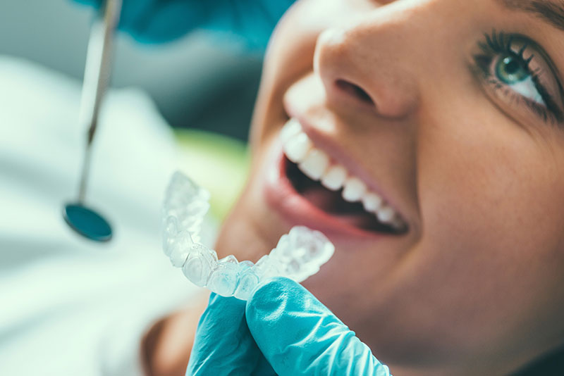 Professional Teeth Whitening | Dentists Kalamazoo, MI | Karen Mitchell Dentistry